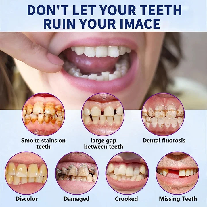 NESLEMY – Fortschrittliches, maßgefertigtes Vollprothesen-Set