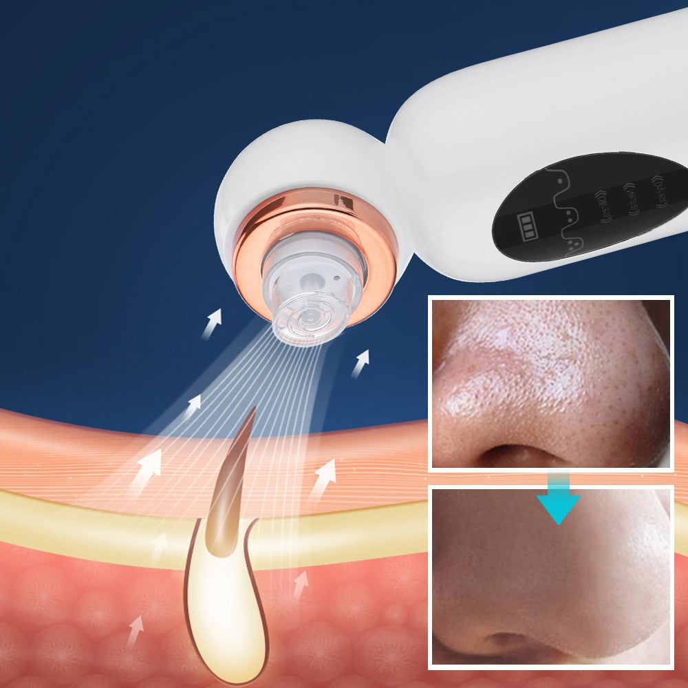 | Hydrodermabrasion Mitesserentferner