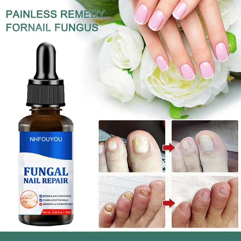 | Nagelpilz Verteidiger Serum