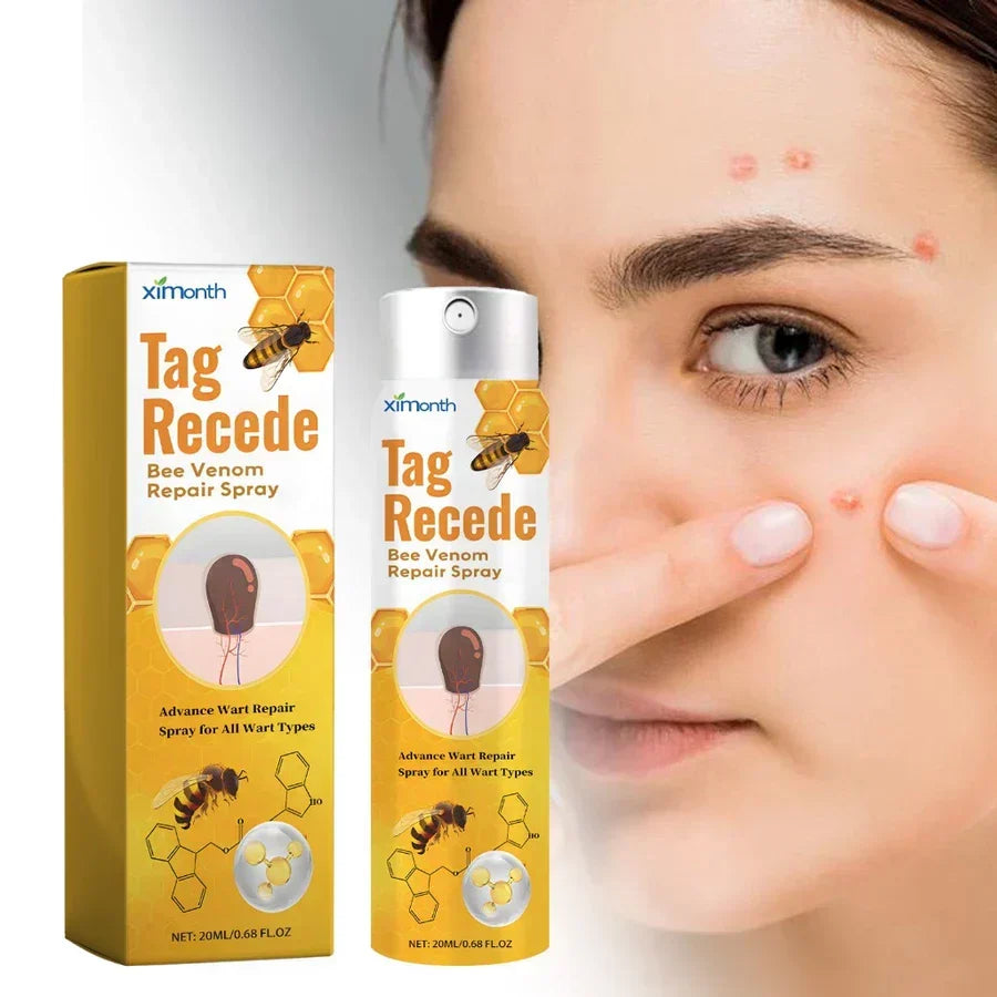 | TagAway- Effektive Entfernung von Warzen und Hautwucherungen