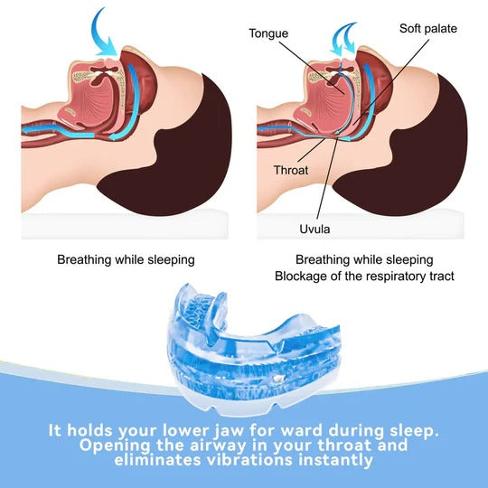 | Verstellbares Anti-Schnarch-Mundstück